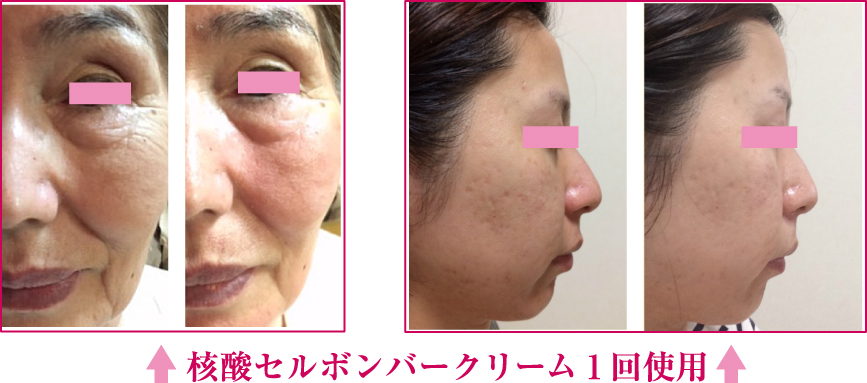 細胞レベルへ直接アプローチする核酸クリーム。 | クロイターピール  